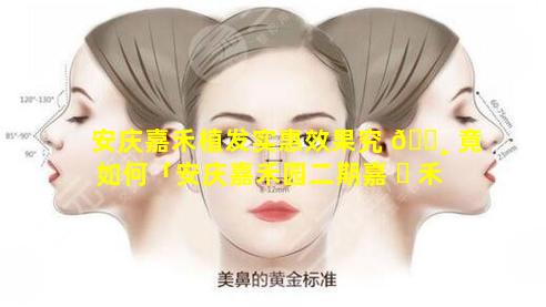 安庆嘉禾植发实惠效果究 🕸 竟如何「安庆嘉禾园二期嘉 ☘ 禾至尊住宅」